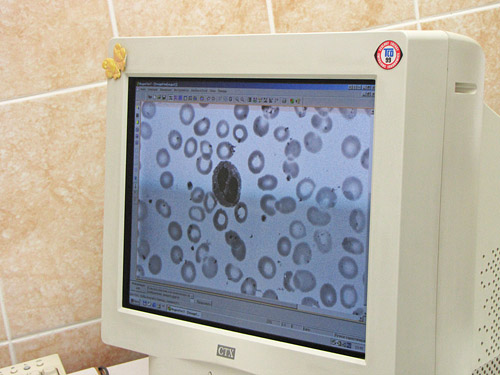 . ��� �������� ����� ����� ��� ���������������� ������.