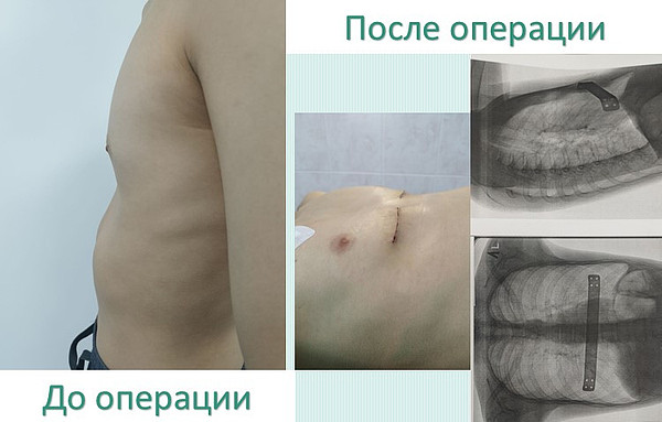 _�� � �����_. 